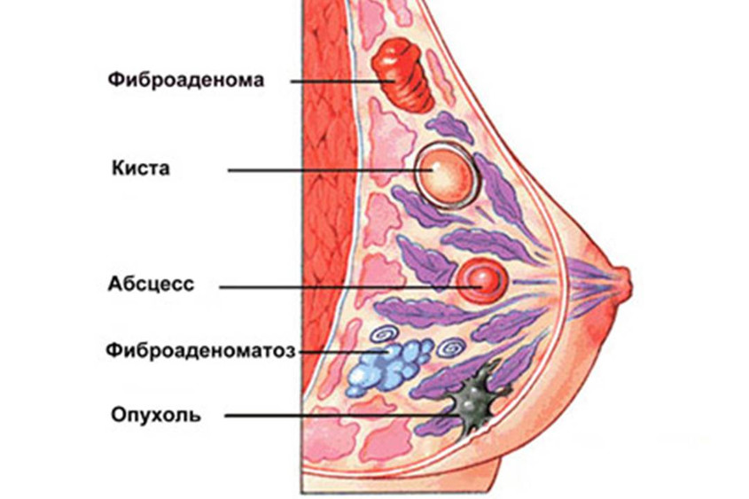 Строение молочных желез