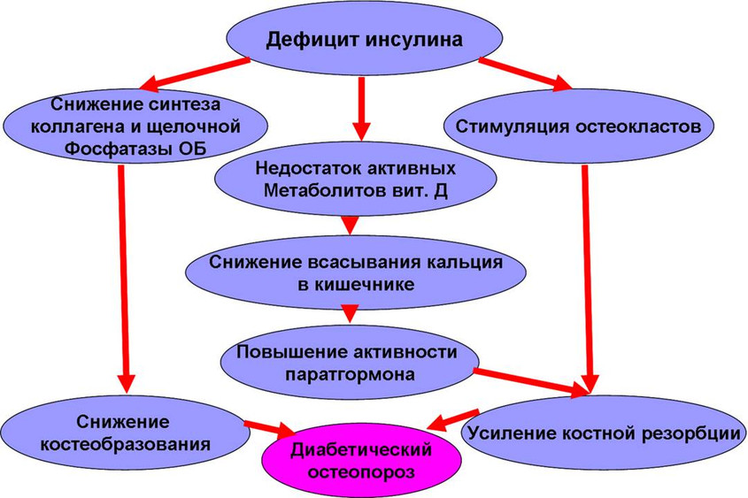 Лечение сахарного диабета